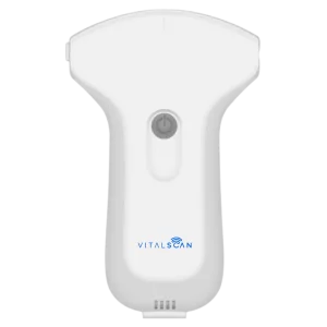 Ecógrafo conectado ultraportátil Vital Scan X3