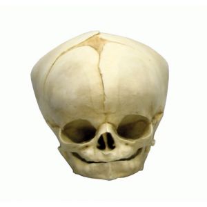 Modelo de Cráneo feto de 40 1/2 semanas 4742 Erler Zimmer