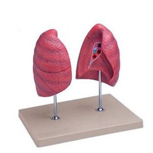 Modelo de pulmones derecho e izquierdo aumentado 1.5 veces