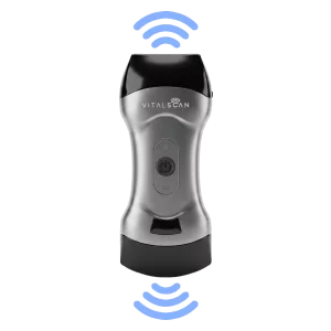 Ecógrafo ultraportátil conectado Vital Scan X5