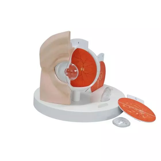 Pathologisches Auge F17 3B Científico 2014 -