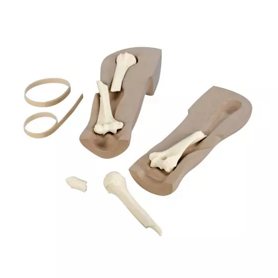 Simulador de diagnóstico por imagen de fractura Life/form® 3B Scientific W44753