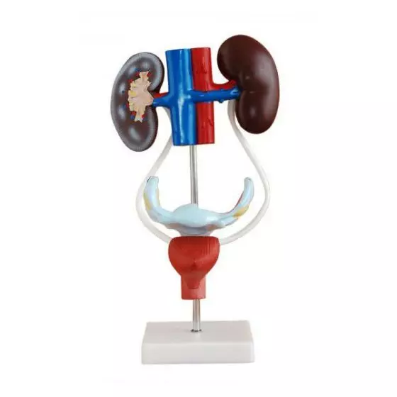 Modelo del sistema urogenital femenino