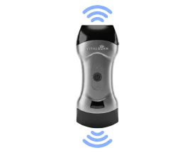 Ecógrafo ultraportátil conectado Vital Scan X5