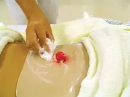 Simulador tipo I para cuidados del estoma con maletín de transporte W60909