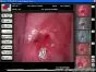 Software de colposcopia para Colpro, Colpy