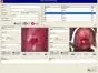 Software de colposcopia para Colpro, Colpy