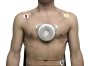 Electrocardiógrafo ECG portátil D-Heart (8 / 12 canales)