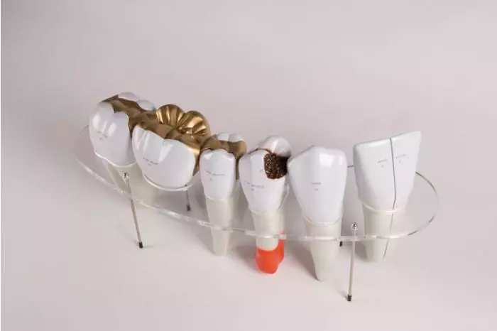Modelo de morfología dental aumentada 10 veces Erler Zimmer R10125