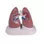 Set de pulmones enfermos G52 Erler Zimmer