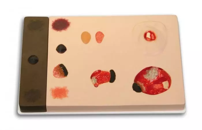 Modelo de úlceras en diferentes etapas Erler Zimmer R10167