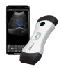Ecógrafo ultraportátil conectado Bionet SonoMe