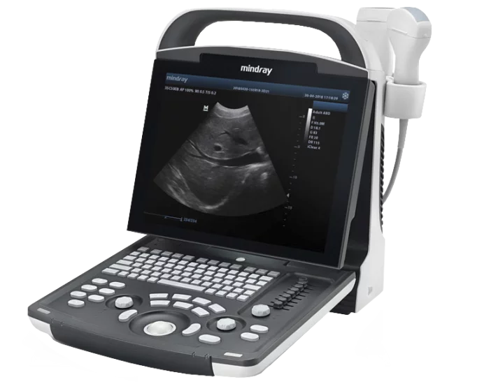 Ecógrafo digital portátil de ultrasonidos Mindray DP-20