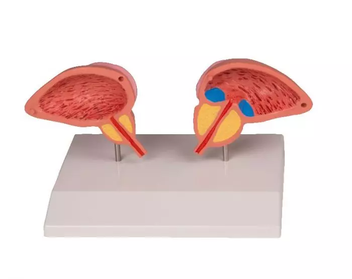 Set de dos mitades de próstata 1261 Erler Zimmer